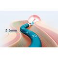 Bebird Earsight Ultra Camera Otoscope for Ear, Nose and Mouth - Blue